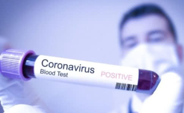 Из-за коронавируса в США перенесли две криптоконференции
