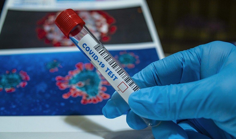Украина уже потратила на борьбу с коронавирусом более 2,60 млрд. грн.